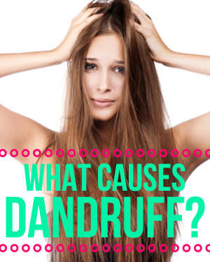  Behind Dandruff as well as a Few Smart Solutions All About What Causes Dandruff ( How to Fix It)