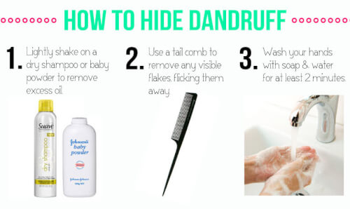  Behind Dandruff as well as a Few Smart Solutions All About What Causes Dandruff ( How to Fix It)