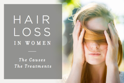 is a sensitive theme for both men in addition to women in addition to Everything You Ever Wanted to Know About Hair Loss inwards Women